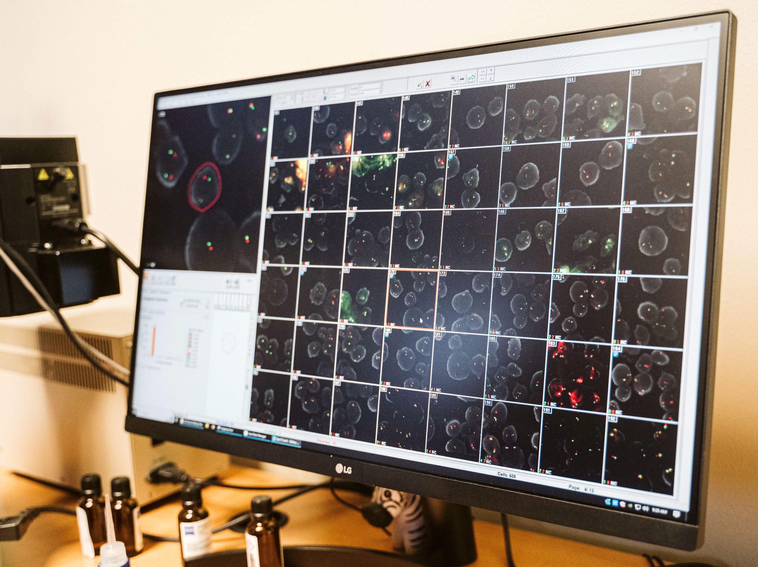 Flourescence In Situ Hybridization is also known as FISH