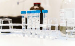 Five blue-capped vials on a rack.