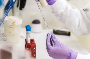 A scientist extracts a sample from a vial using a pipette.