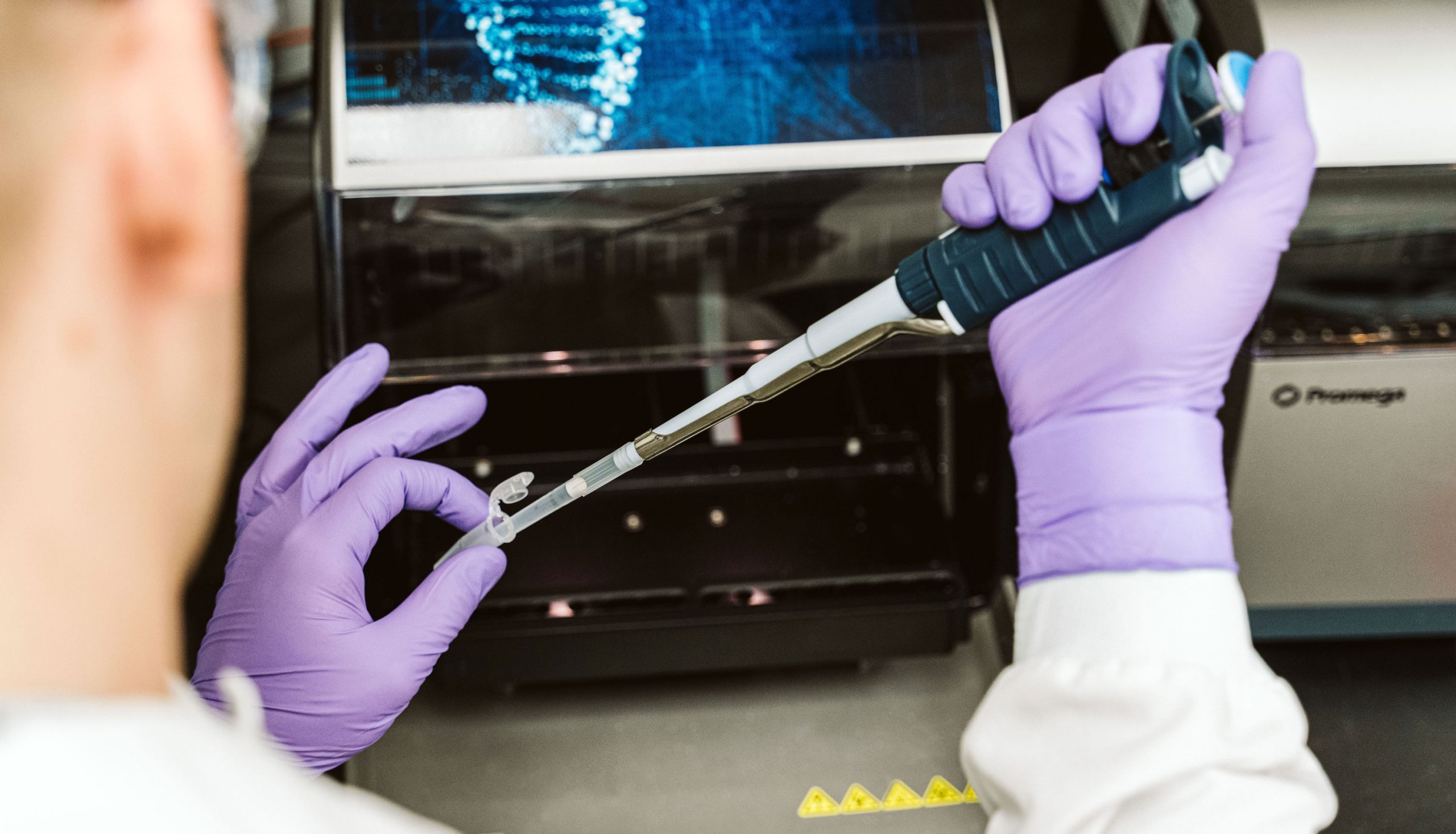 A pipette extracts a biological sample from a small vial.