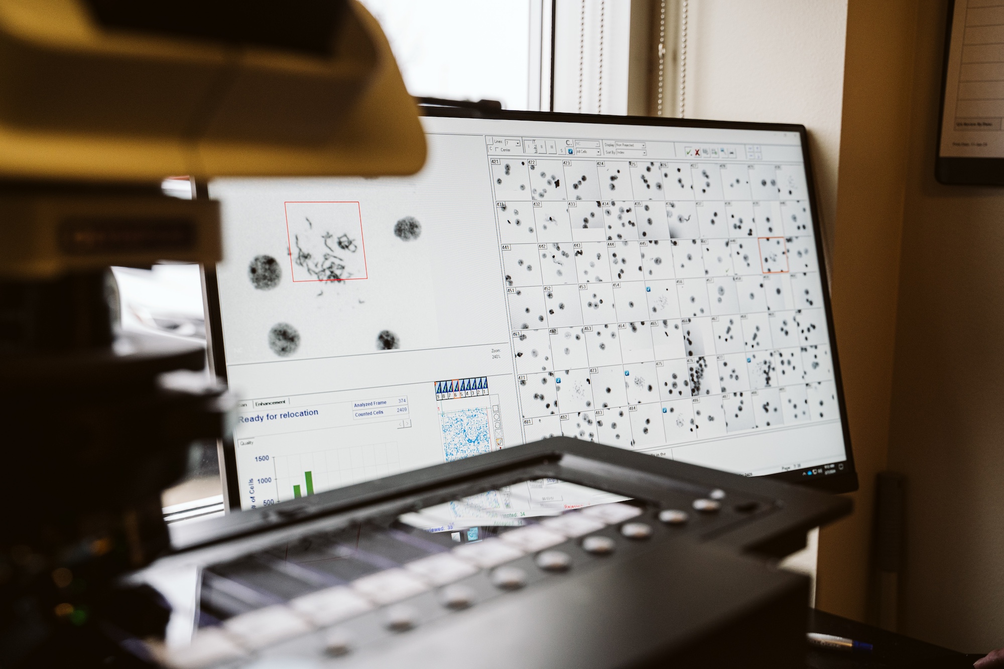WiCell provides careful and accurate karyotype analysis