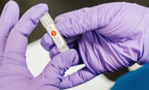 Hands wearing purple gloves hold a small vial with the WiCell logo. 