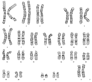 Normal female karyotype