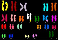 Abnormal spectral karyotype of a four-way translocation.