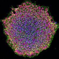 Human induced pluripotent stem cell colony stained to highlight OCT4 in red. Credit: National Eye Institute/NIH