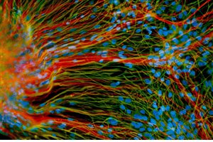 Neurons Derived from Stem Cells - SuChun Zhang - UW Madison