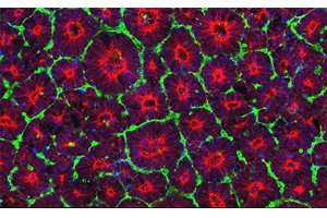 Neural Rosettes from Stem Cells - Randolph Ashton - UW Madison